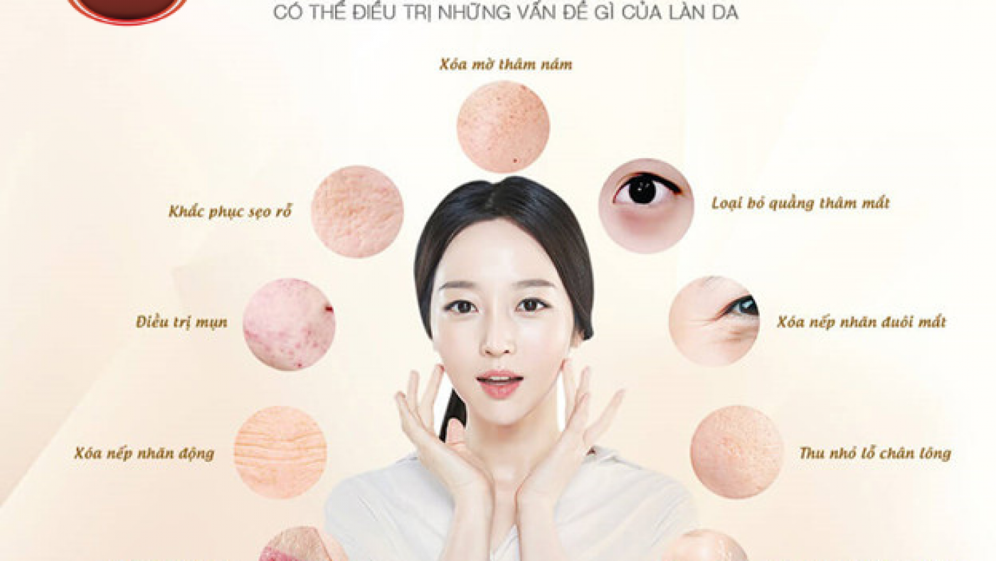 1642128683_untitled-design