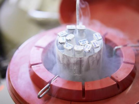 Cách bảo quản tinh trùng